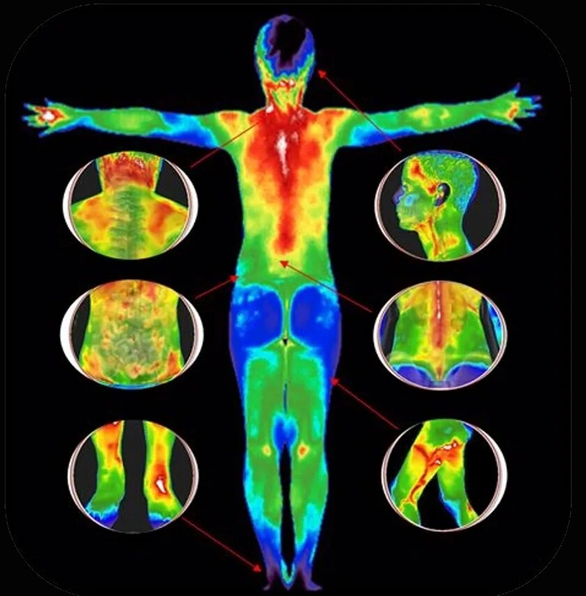 A full body thermal study, with detail views of the back, abdomen, legs, shoulders and hips