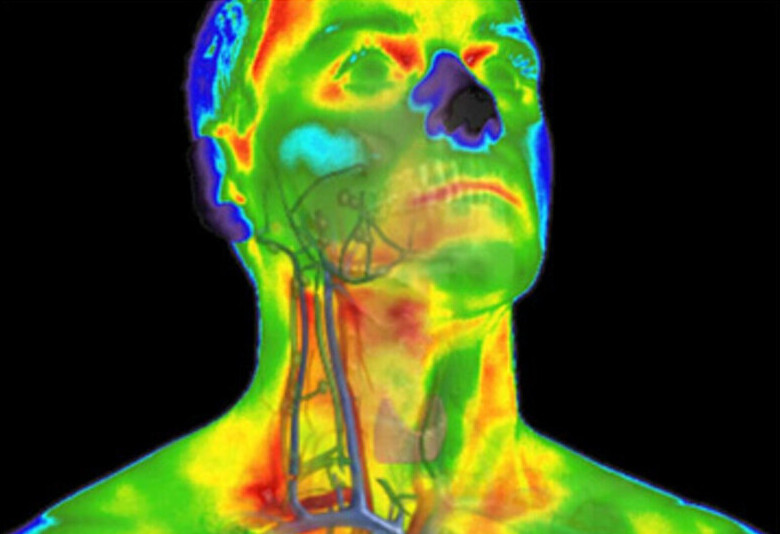Thermal image of the head, neck and thyroid region